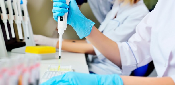 Nova técnica revela em larga escala como milhares de proteínas mudam de forma e se movimentam