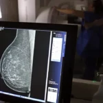 Saiba qual é a rotina ideal de consultas para cuidar da visão