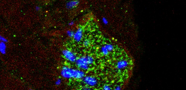 Estrutura que controla a pressão arterial também age como ‘radar’ de inflamação