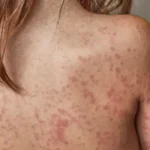 Cremerj promove campanha de doação de sangue em parceria com Hemorio