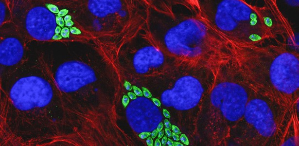 Proteína pouco conhecida é potencial alvo contra a doença de Chagas