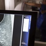 Idosos mais ativos têm volume cerebral preservado em áreas de memória e raciocínio