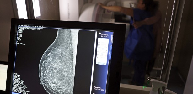 Boletim detalha criação de sistema digital para organizar o rastreamento de câncer no SUS