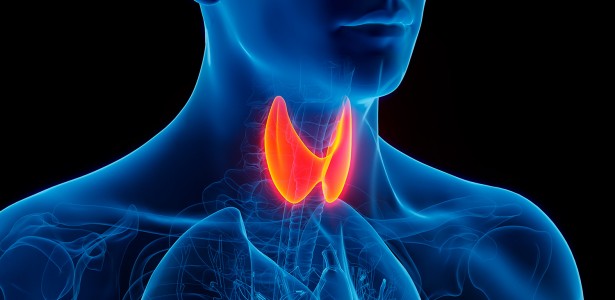 Inteligência artificial prevê risco de complicação após cirurgia de tireoide